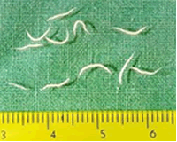 Pinworm