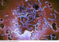 Mycobacterium